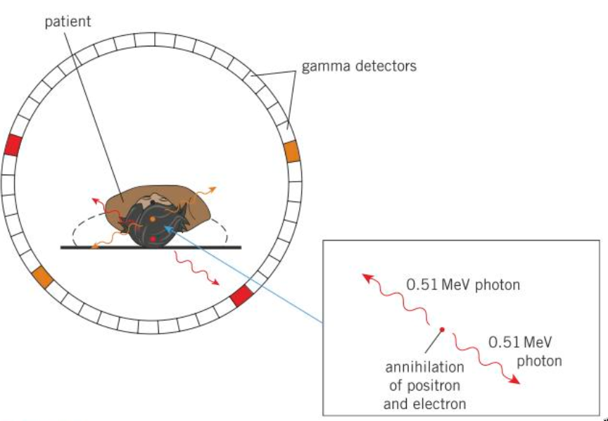 PHOTO PET SCANNER