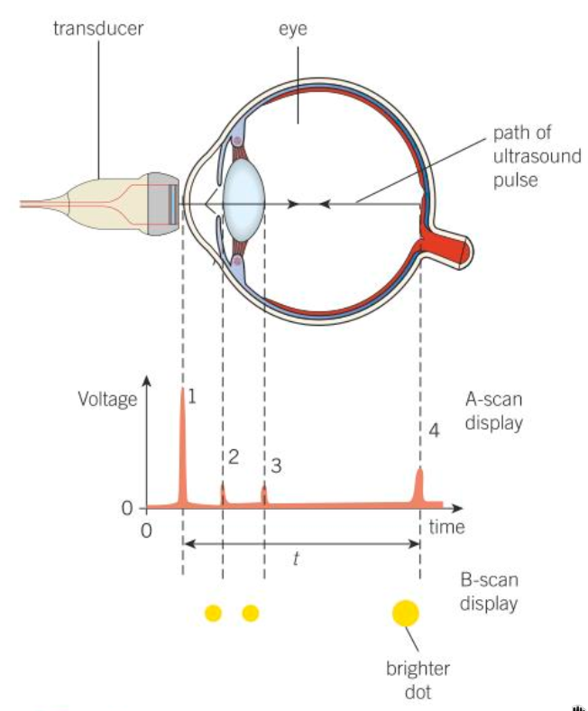 PHOTO ULTRASOUND DETECTION